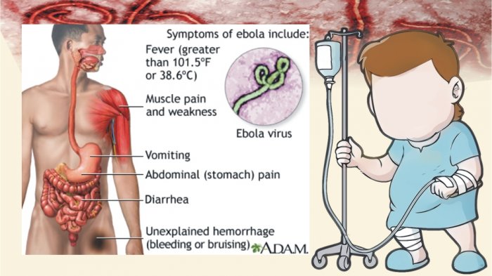 Virus Ebola Virus Berbahaya Selain Corona